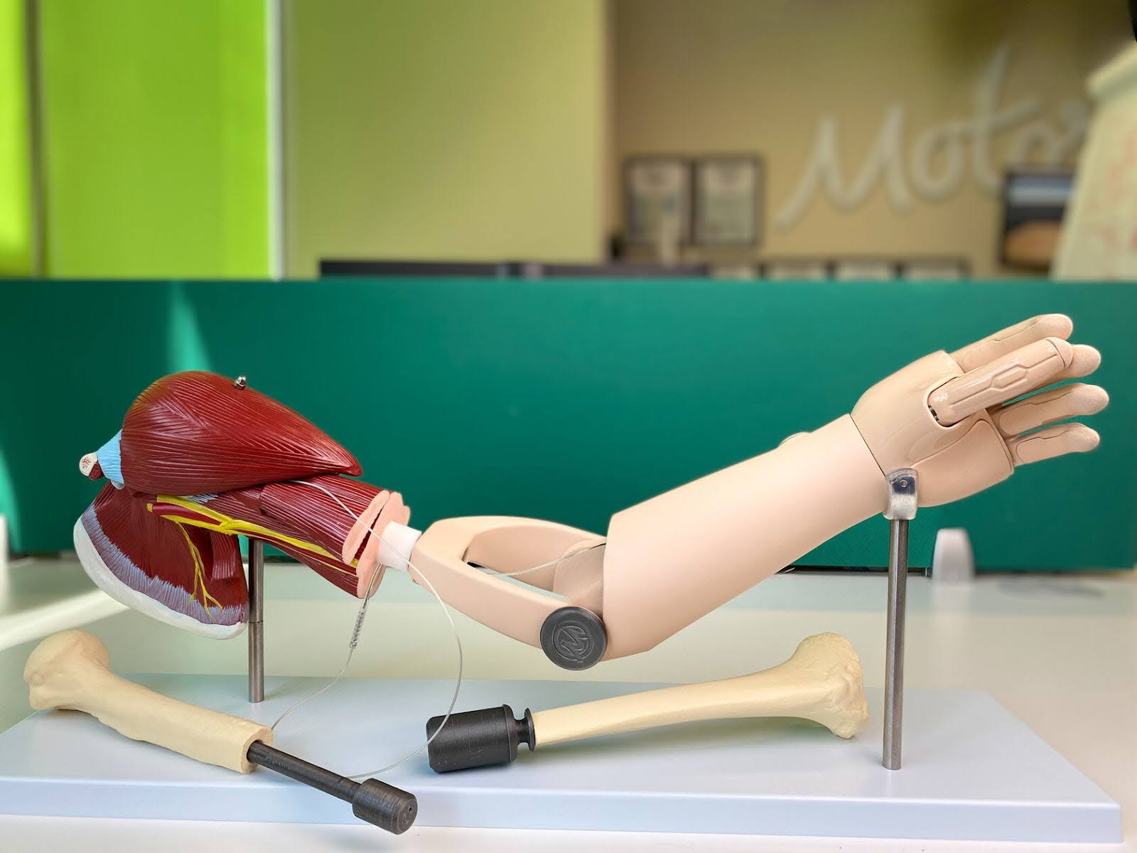 В России прошли первые успешные испытания остеоинтегрируемых протезов